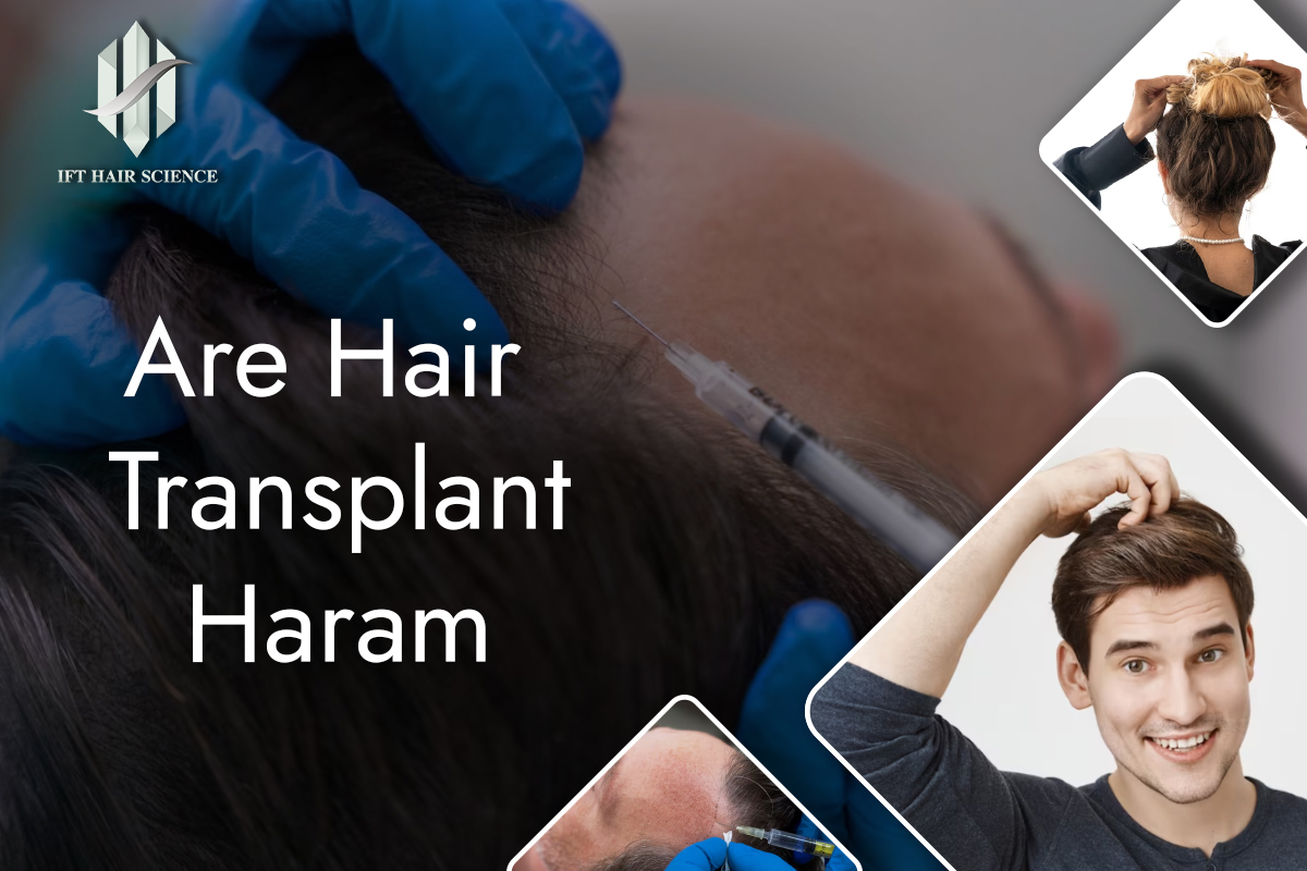 Are hair transplant haram